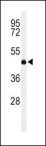 Anti-LCAT Rabbit Polyclonal Antibody (HRP (Horseradish Peroxidase))