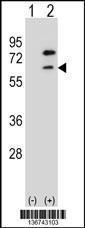 Anti-ZBTB7B Rabbit Polyclonal Antibody (APC (Allophycocyanin))