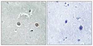 Antibody anti-NDUFB10 100 µg