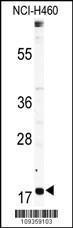 Anti-RPL23A Rabbit Polyclonal Antibody (APC (Allophycocyanin))