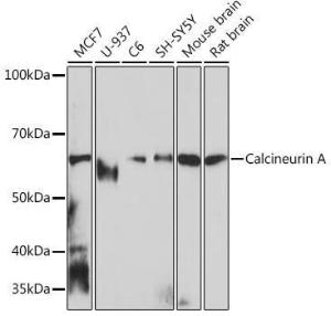 Western blot analysis of extracts of various cell lines, using Anti-Calcineurin A Antibody [ARC0970] (A308927) at 1:1,000 dilution The secondary antibody was Goat Anti-Rabbit IgG H&L Antibody (HRP) at 1:10,000 dilution Lysates/proteins were present at 25 µg per lane