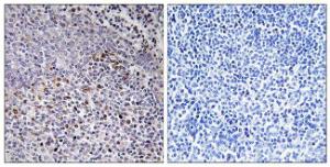 Immunohistochemical analysis of paraffin-embedded human tonsil tissue using Anti-Cytochrome c-type Heme Lyase Antibody. The right hand panel represents a negative control, where the antibody was pre-incubated with the immunising peptide