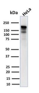 Western blot analysis of human HeLa cell lysate using Anti-MSH6 Antibody [MSH6/3085]