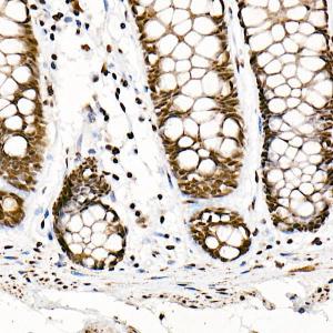 Immunohistochemistry analysis of paraffin-embedded human colon tissue using Anti-SF2 Antibody [ARC51453] (A306007) at a dilution of 1:100 (40X lens). Perform high pressure antigen retrieval with 10 mM citrate buffer pH 6.0 before commencing with IHC staining protocol