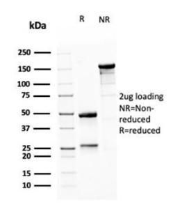 SDS-PAGE analysis of Anti-MSH6 Antibody [MSH6/3085] under non-reduced and reduced conditions; showing intact IgG and intact heavy and light chains, respectively. SDS-PAGE analysis confirms the integrity and purity of the Antibody