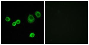 Immunofluorescence analysis of MCF7 cells using Anti-Cytochrome c-type Heme Lyase Antibody. The right hand panel represents a negative control, where the antibody was pre-incubated with the immunising peptide