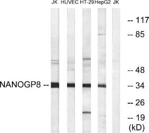 Western blot analysis of lysates from HUVEC, HT-29, HepG and Jurkat cells using Anti-NANOGP8 Antibody. The right hand lane represents a negative control, where the Antibody is blocked by the immunising peptide