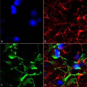 Immunocytochemistry/Immunofluorescence analysis of human neuroblastoma cells (SH-SY5Y), fixed in 4% PFA for 15 min, using Anti-ABCC9 Antibody [S319A-14] (A304816), at 1:200 for overnight at 4 °C with slow rocking