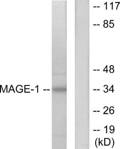 Anti-MAGE-1 Rabbit Polyclonal Antibody