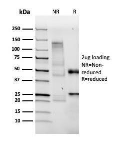 Anti-BrdU Rabbit Recombinant Antibody [clone: BRDU/3902R]