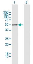 Anti-CHRDL2 Rabbit Polyclonal Antibody