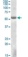 Anti-EYA1 Goat Polyclonal Antibody