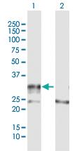 Anti-ADAMTS4 Rabbit Polyclonal Antibody