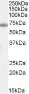 Anti-XRCC6 antibody