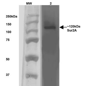 Western blot analysis of rat brain membrane showing detection of ~120 kDa SUR2A protein using Anti-ABCC9 Antibody [S319A-14] (A304816) at 1:1,000 for 1 hour at room temperature