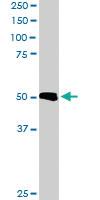 Anti-TXNDC5 Goat Polyclonal Antibody