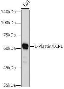 Anti-Plastin L Rabbit Monoclonal Antibody [clone: ARC2689]