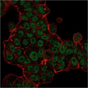 Immunofluorescent analysis of MCF-7 cells stained with Anti-MSH6 Antibody [MSH6/3085] followed by Goat Anti-Mouse IgG (CF&#174; 488) (Green). Membrane stained with Phalloidin (Red)