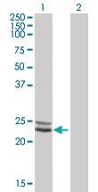 Anti-NDUFV2 Mouse Polyclonal Antibody