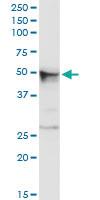 Anti-CHRDL2 Rabbit Polyclonal Antibody