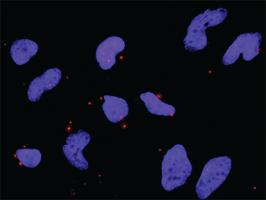 Anti-FLT1 + PIK3R1 Antibody Pair