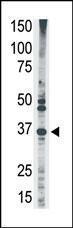 Anti-MAGEA2 Rabbit Polyclonal Antibody (AP (Alkaline Phosphatase))