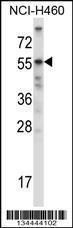 Anti-ACVR2B Rabbit Polyclonal Antibody (APC (Allophycocyanin))