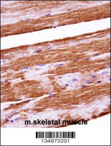 Anti-RAF1 Rabbit Polyclonal Antibody (AP (Alkaline Phosphatase))