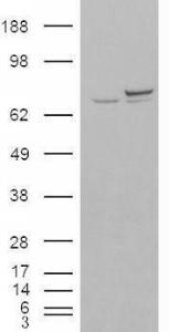 Anti-XRCC6 antibody