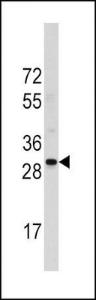 Anti-RPS6 Rabbit Polyclonal Antibody (AP (Alkaline Phosphatase))