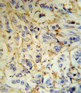 Anti-FGA Rabbit Polyclonal Antibody