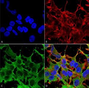 Immunocytochemistry/Immunofluorescence analysis of human neuroblastoma cell line (SK-N-BE, fixed in 4% formaldehyde for 15 min at room temperature, using Anti-ABCC9 Antibody [S319A-14] (A304816), at 1:100 for 60 minutes at room temperature