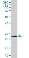 Anti-NDUFV2 Mouse Polyclonal Antibody