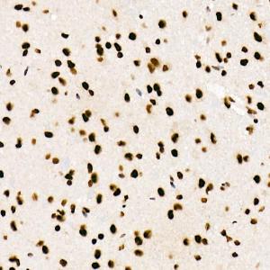 Immunohistochemistry analysis of paraffin-embedded mouse brain using Anti-SF2 Antibody [ARC51453] (A306007) at a dilution of 1:100 (40X lens). Perform high pressure antigen retrieval with 10 mM citrate buffer pH 6.0 before commencing with IHC staining protocol