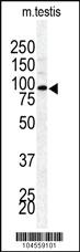 Anti-BAP1 Rabbit Polyclonal Antibody