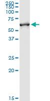 Anti-FMO3 Polyclonal Antibody Pair