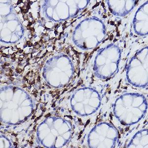 Anti-Plastin L Rabbit Monoclonal Antibody [clone: ARC2689]