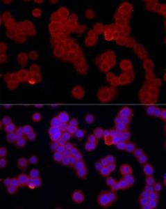 Immunofluorescence analysis of HL-60 cells using Anti-FPRL1 / RFP Antibody (A309939) at a dilution of 1:50 (40x lens). DAPI was used to stain the cell nuclei (blue).