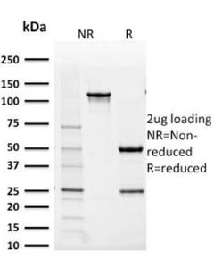 SDS-PAGE analysis of Anti-AKR1B1 Antibody [CPTC-AKR1B1-2] under non-reduced and reduced conditions; showing intact IgG and intact heavy and light chains, respectively. SDS-PAGE analysis confirms the integrity and purity of the antibody