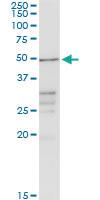 Anti-CHRDL2 Rabbit Polyclonal Antibody