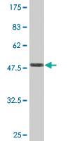 Anti-TAGLN Mouse Monoclonal Antibody [clone: 1E2]