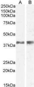 Anti-l12b Antibody (A84360) (0.5 µg/ml) staining of Mouse (A) and Rat (B) Skin lysate (35 µg protein in RIPA buffer). Primary incubation was 1 hour. Detected by chemiluminescence