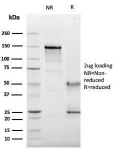 SDS-PAGE analysis of Anti-CD63 Antibody [LAMP3/2789] under non-reduced and reduced conditions; showing intact IgG and intact heavy and light chains, respectively. SDS-PAGE analysis confirms the integrity and purity of the antibody.