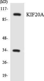 Anti-KIF20A antibody