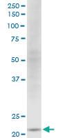 Anti-NDUFV2 Mouse Monoclonal Antibody [clone: 1A10]