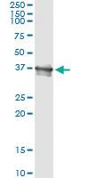 Anti-BCL2L14 Antibody Pair