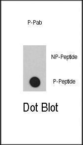 Anti-EP300 Rabbit Polyclonal Antibody (Biotin)