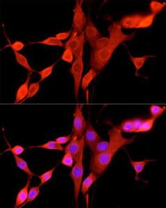 Immunofluorescence analysis of NIH/3T3 cells using Anti-FPRL1 / RFP Antibody (A309939) at a dilution of 1:50 (40x lens). DAPI was used to stain the cell nuclei (blue).