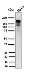 Western blot analysis of human HeLa cell lysate using Anti-MSH6 Antibody [MSH6/3085]