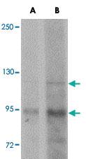 Anti-KDM3A Rabbit Polyclonal Antibody